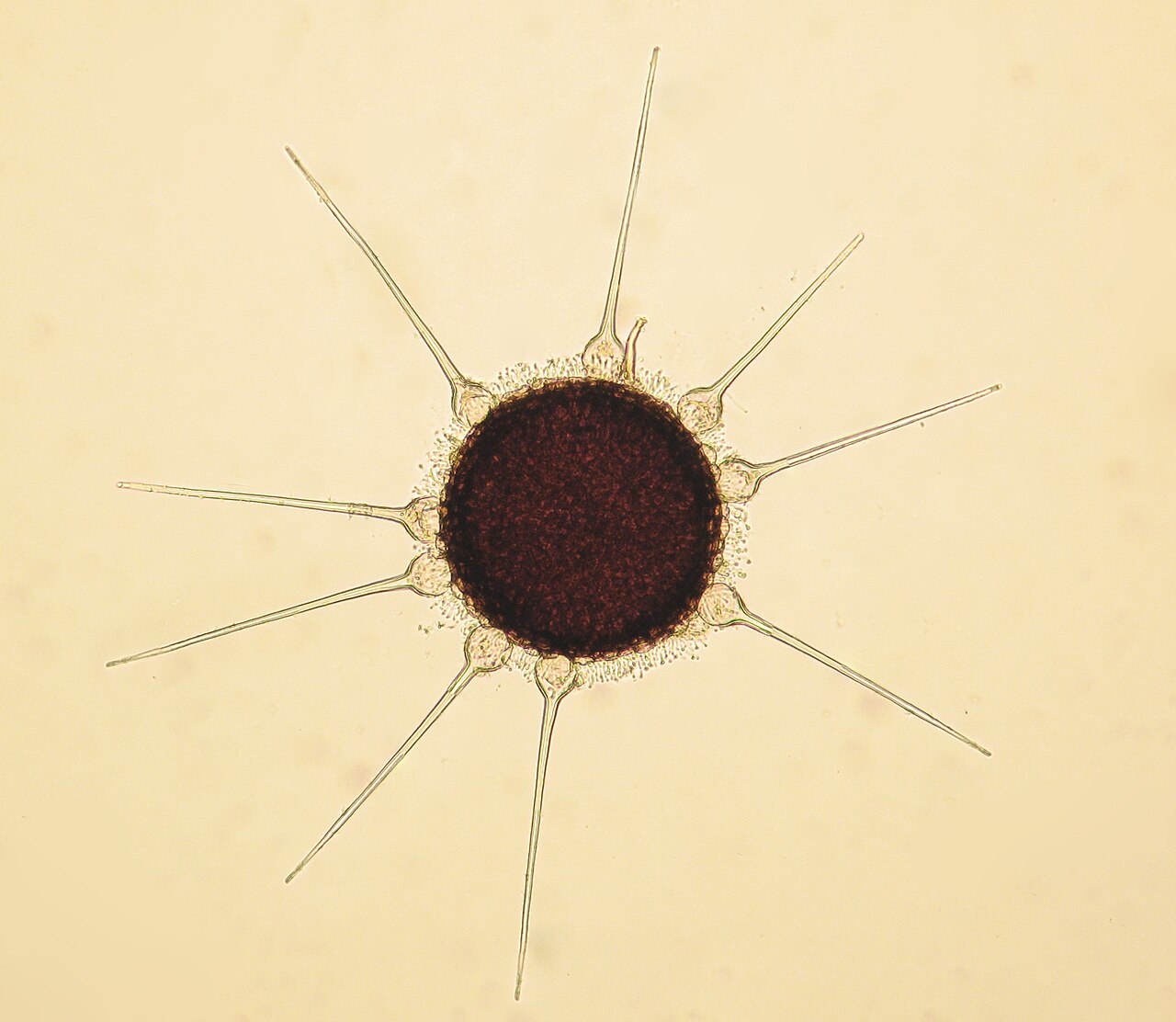 Corpo fruttifero (cleistoteci) del fungo dell'oidio del nocciolo (Phyllactinia guttata) al microscopio