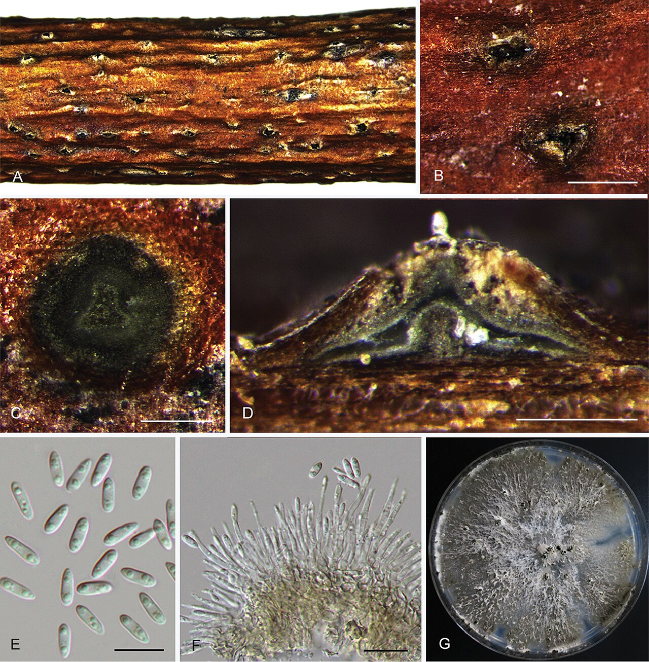 Diaporthe eres (anamorfo Phomopsis) — vista microscopica dei corpi fruttiferi e delle spore del fungo del complesso del cancro dei rami