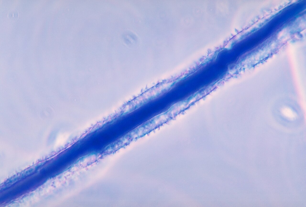 Muffa Aspergillus flavus, produttrice di aflatossine
